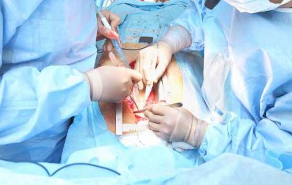 Surgical Navigation Systems Market Trends, scope, growth overview with major technology giants