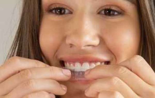 Complete Guide to Crest Teeth Whitening Strips: Achieve a Brighter Smile