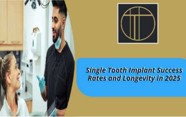 Single Tooth Implant Success Rates and Longevity in 2025