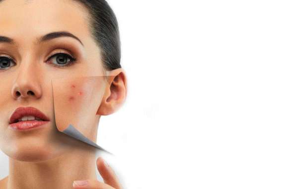 Benefits of Regular Check-Ups at a Skincare Clinic in Bangalore